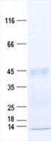 Human AS3MT Protein (Recombinant His, N-Terminal)