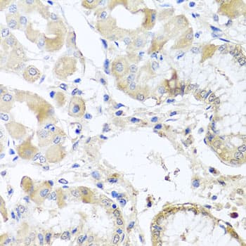 Polyclonal Rabbit anti-Human RPL36 / Ribosomal Protein L36 Antibody (IHC, WB)