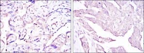 Monoclonal Mouse anti-Human Papillomavirus 16 HPV E7 Antibody (clone 2C11, IHC, WB)
