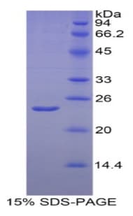 Human HIF2A / EPAS1 Protein (Recombinant His)