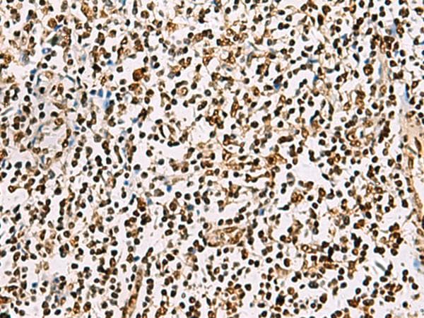 FOXI1 Antibody