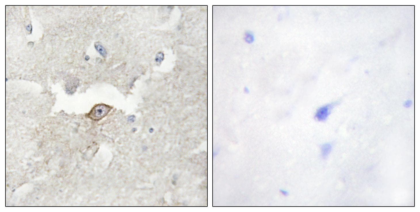Polyclonal Rabbit anti-Human KPI-2 / LMTK2 Antibody (IHC, IF, WB)