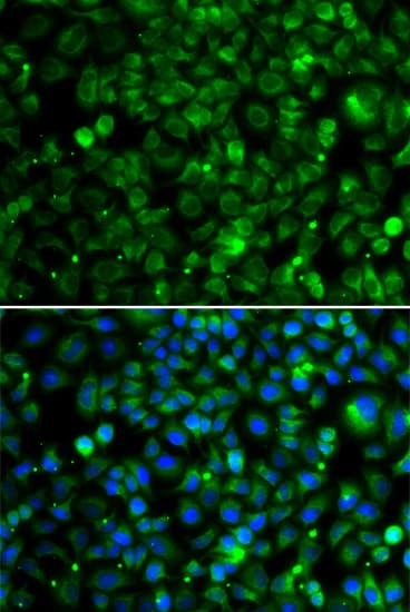 TMLHE / TMID Antibody