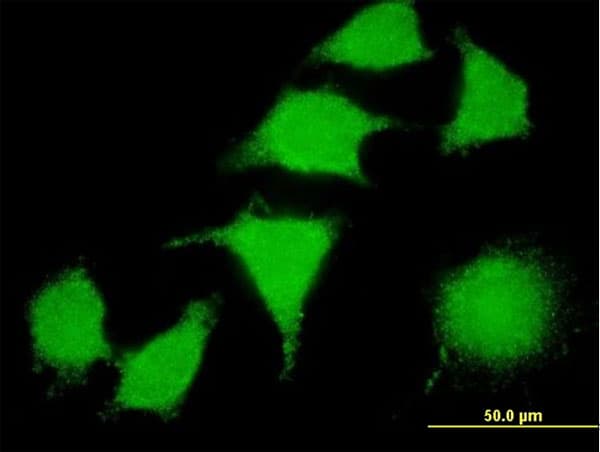LIMK2 Antibody (clone 2H2-E11)