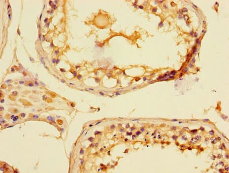 PIM2 / Pim-2 Antibody