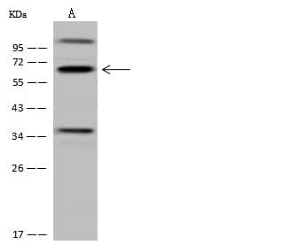 Polyclonal Rabbit anti-Human CDYL Antibody (IHC, IF, WB)