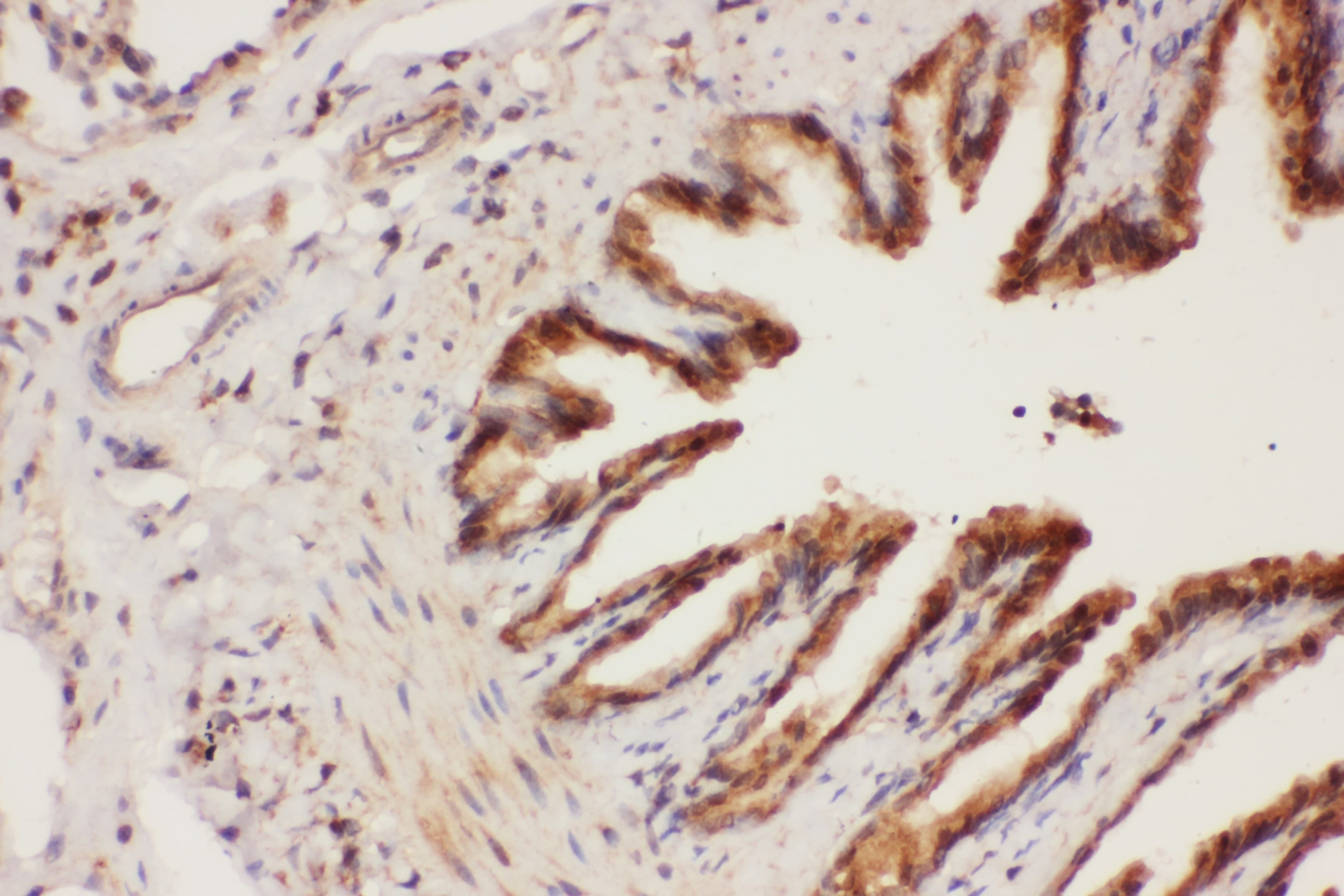 Polyclonal Rabbit anti-Human ALOX15 / 15-Lipoxygenase Antibody (aa2-337, IHC, WB)