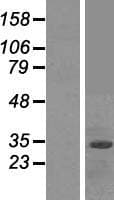 FBXO2 Protein (Over-Expression Lysate Myc-DDK (Flag))