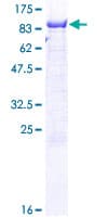 Human PGM2 Protein (Recombinant GST)