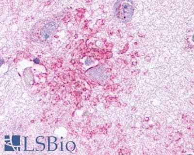PathPlus™ CCR3 Antibody (C-Terminus)