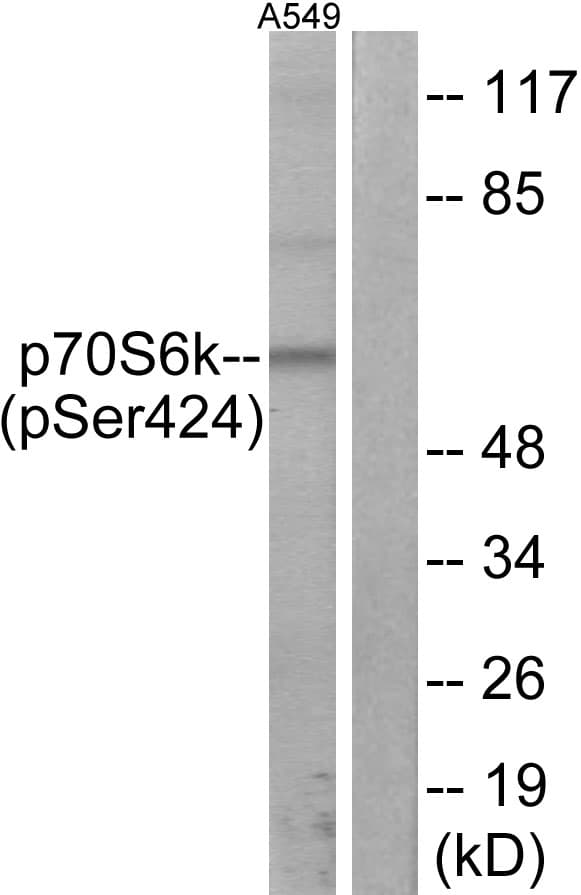 RPS6KB1 / P70S6K / S6K Antibody (phospho-Ser424)