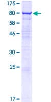 Human AVL9 Protein (Recombinant GST)