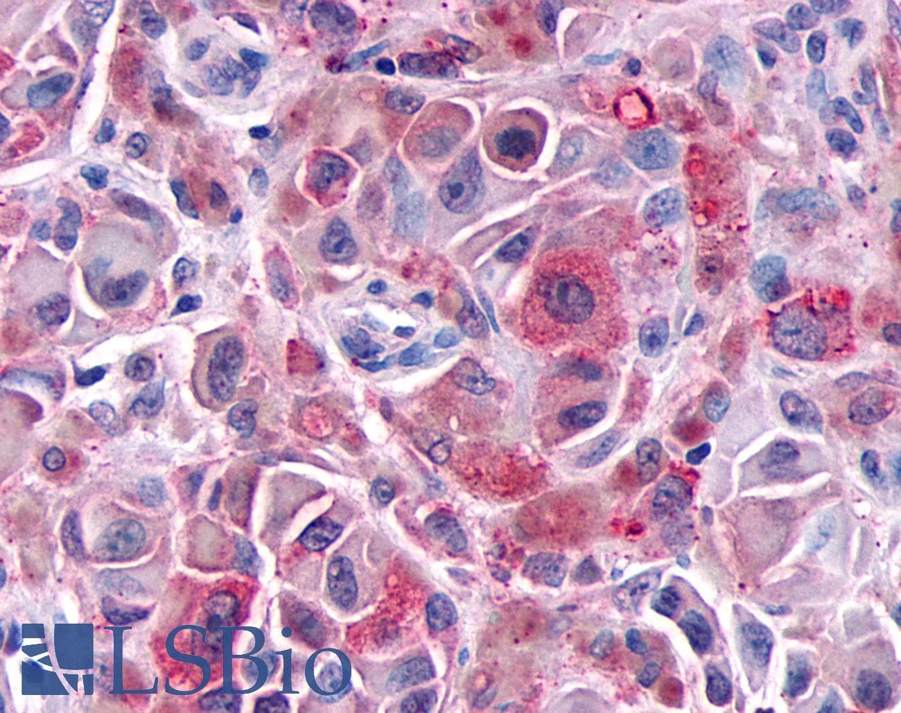 PathPlus™ GALR1 / Galanin Receptor 1 Antibody (N-Terminus)