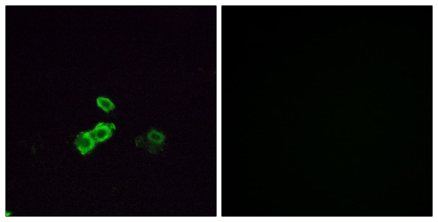 OR14J1 Antibody (aa272-321)