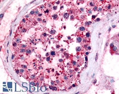 PathPlus™ Polyclonal Rabbit anti-Human PGES / PTGES Antibody (Cytoplasmic Domain, IHC)