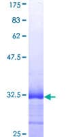 Human SPINK1 Protein (Recombinant GST, N-terminus)
