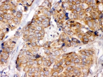 EIF4A2 Antibody