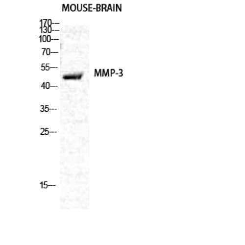 MMP3 Antibody (390-470 aa, C-terminal)