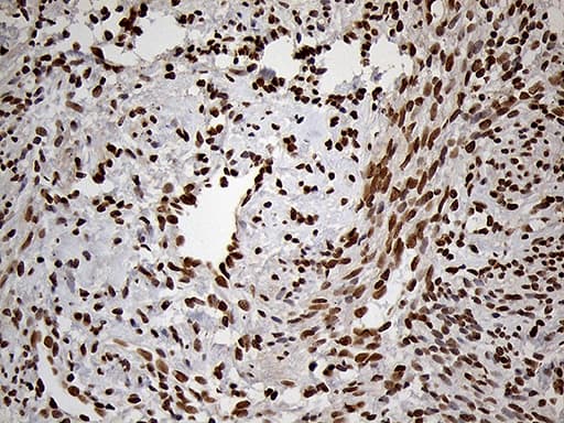 MEIS1 Antibody (aa176-390, clone OTI3G8)