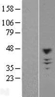 CHST10 Protein (Over-Expression Lysate Myc-DDK (Flag))