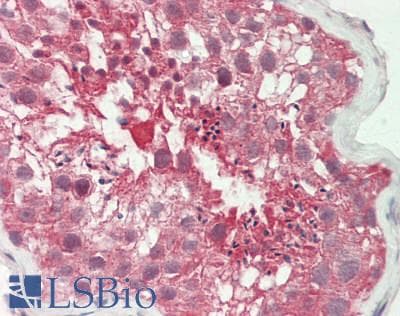 BCKDK Antibody (aa111-160)