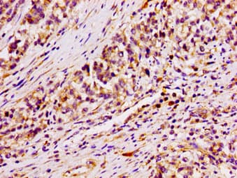 ARID3A / DRIL1 Antibody