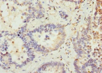 Polyclonal Rabbit anti-Human VANGL2 / LTAP Antibody (IHC, WB)