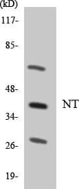 NTM / Neurotrimin Antibody (aa218-267)