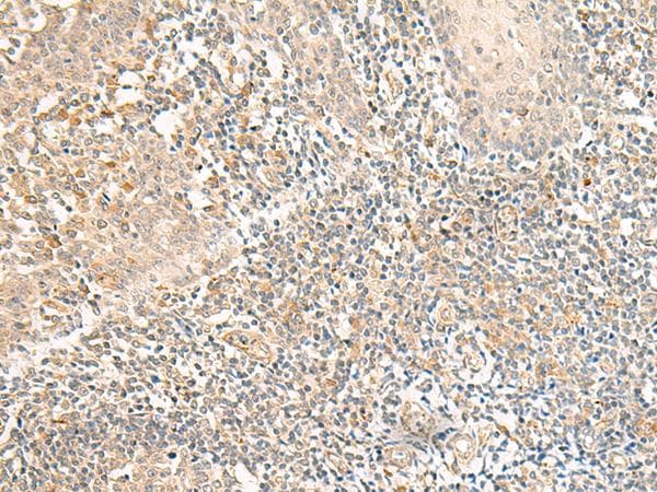 GPR157 Antibody