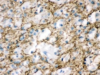 Polyclonal Rabbit anti-Human STXBP1 / MUNC18-1 Antibody (IHC, WB)