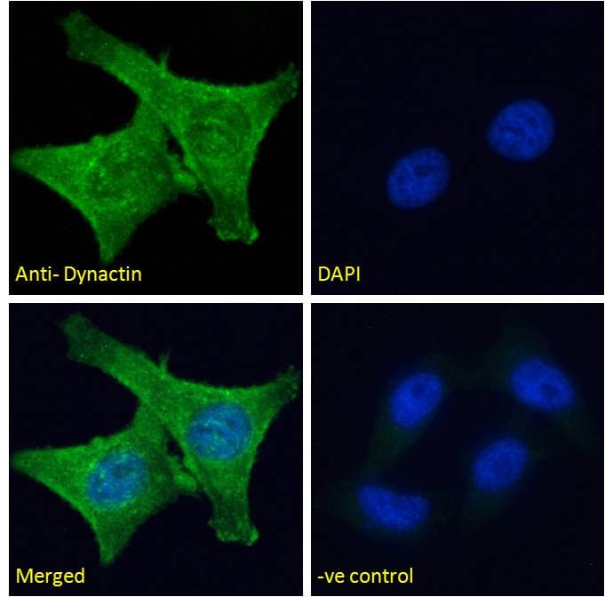 IHC-plus™ Polyclonal Goat anti-Human DCTN1 / Dynactin 1 Antibody (aa1266-1278, IHC, IF, WB)