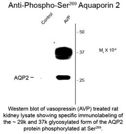 AQP2 / Aquaporin 2 Antibody (phospho-Ser269)