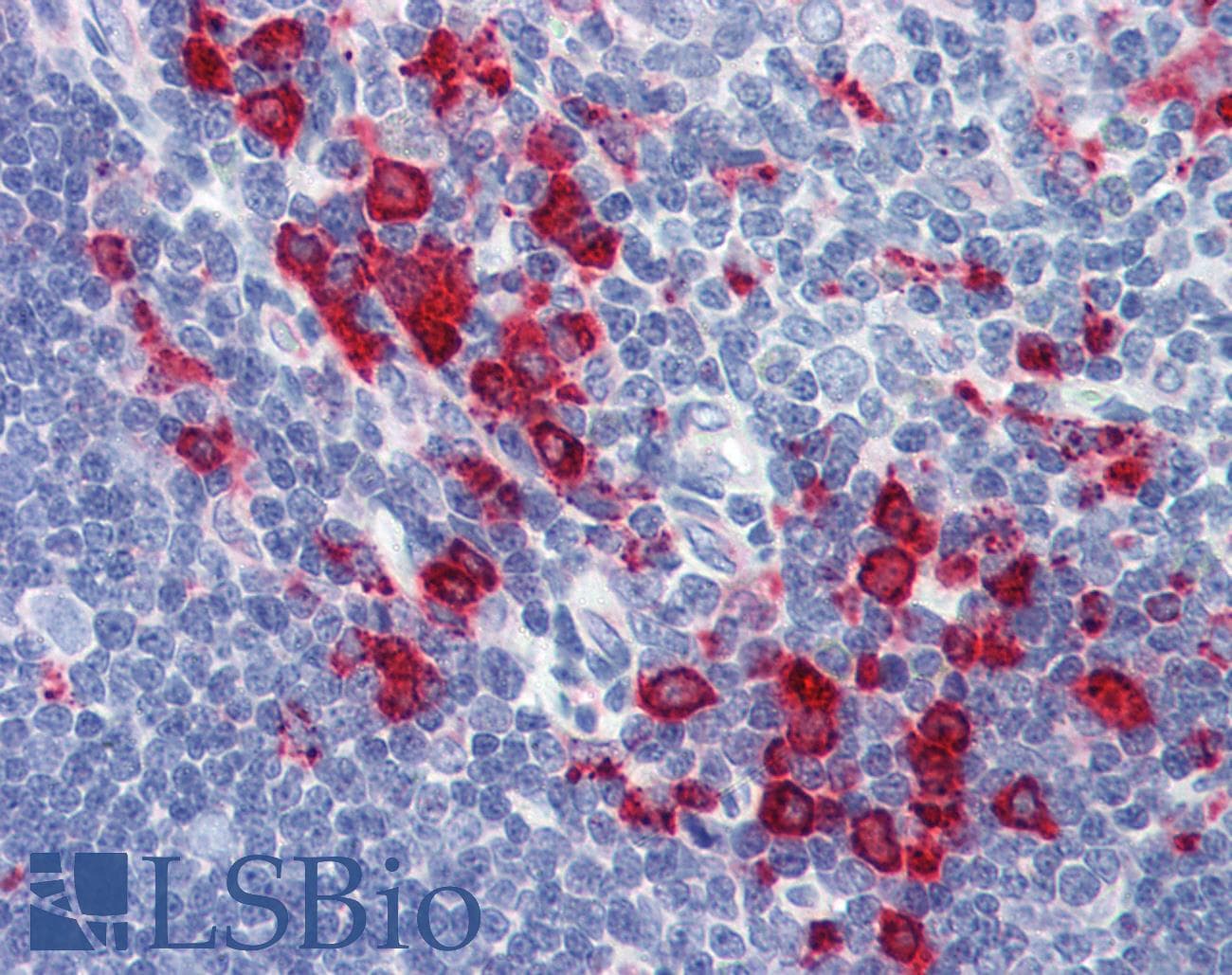 IHC-plus™ CD68 Antibody (clone KP1)