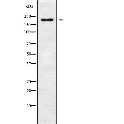 Polyclonal Rabbit anti-Human RGPD5 Antibody (WB)