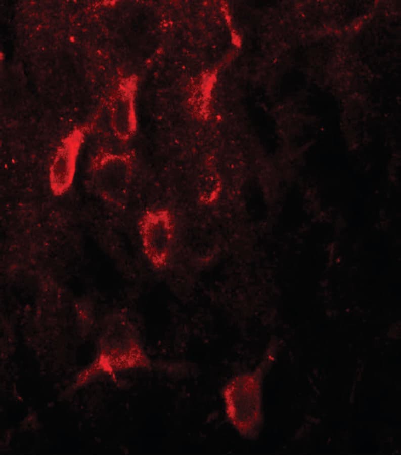 ER Alpha / Estrogen Receptor Antibody