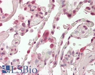 IHC-plus™ UBAP2L Antibody