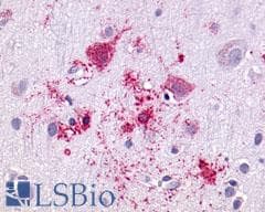 PathPlus™ GPR55 Antibody (C-Terminus)