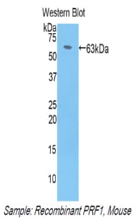 PRF1 / Perforin Antibody (aa40-355, Cy3)