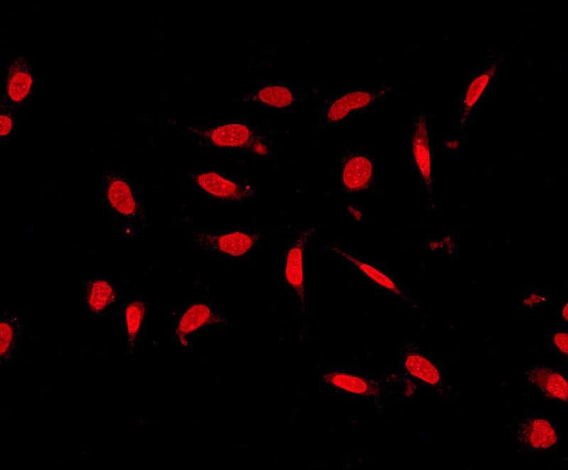 IHC-plus™ USP11 Antibody (Internal, clone EPR4346)