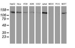 Monoclonal Mouse anti-Human HDAC6 Antibody (clone OTI5E6, IHC, IF, WB)