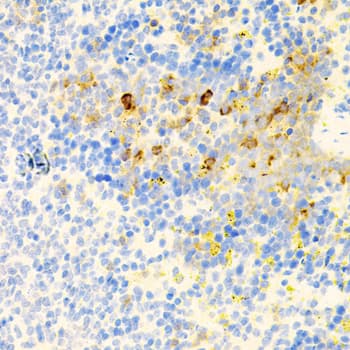 PK2 / PROK2 Antibody