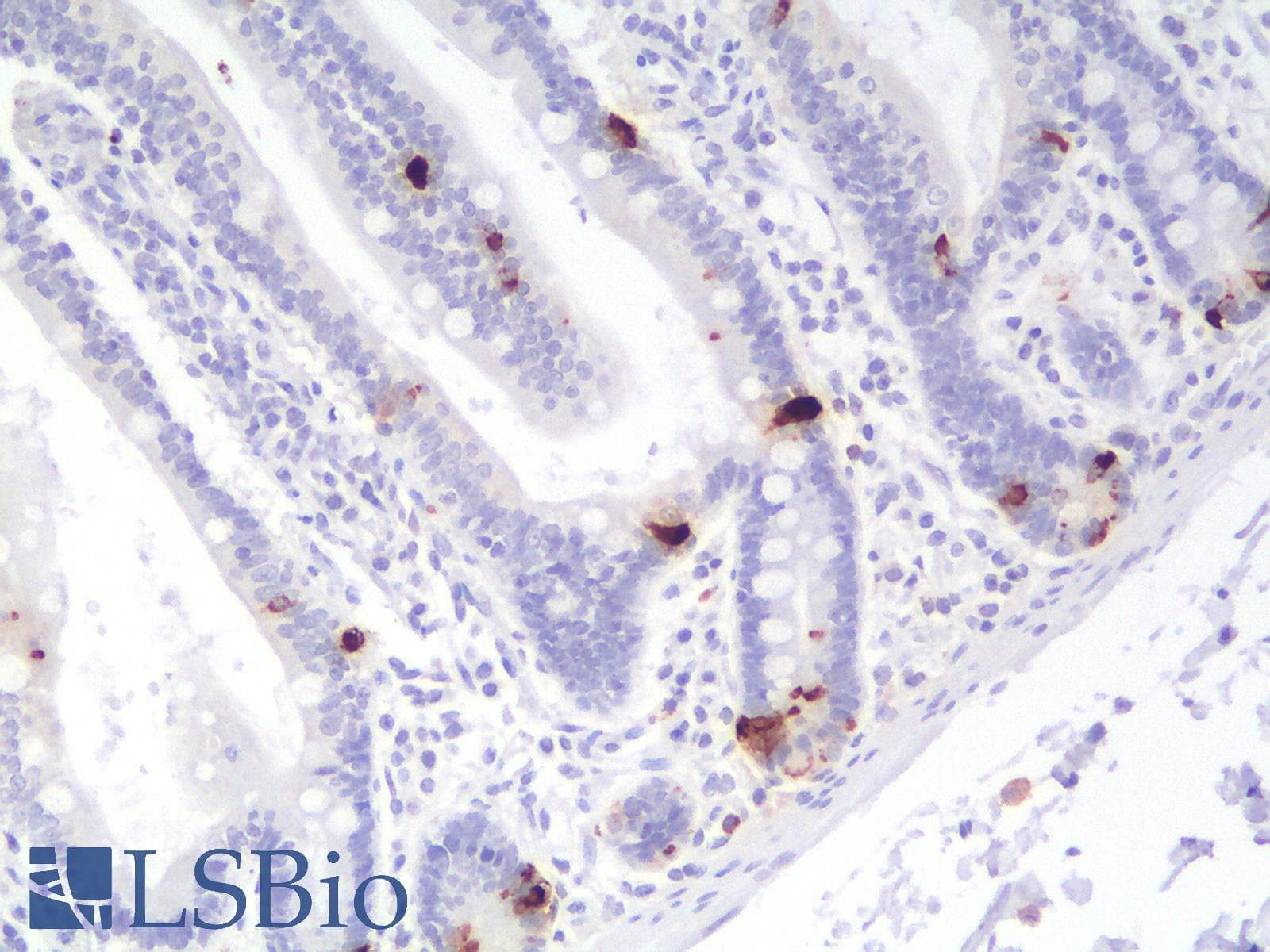 PathPlus™ CHGA / Chromogranin A Antibody (clone CHGA/1773R)