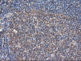 TUBAL3 Antibody (clone OTI4C5)