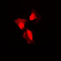 TP53 / p53 Antibody (phospho-Ser315)