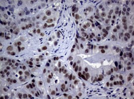 NBN / Nibrin Antibody (clone OTI3A4)