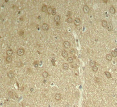 MAPT / Tau Antibody (phospho-Thr205)