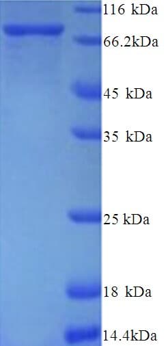 Human PAD2 / PADI2 Protein (Recombinant His)