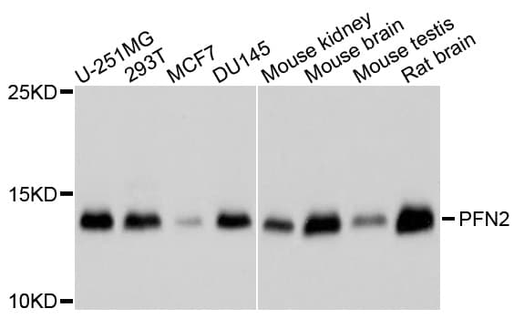 PFN2 / Profilin 2 Antibody