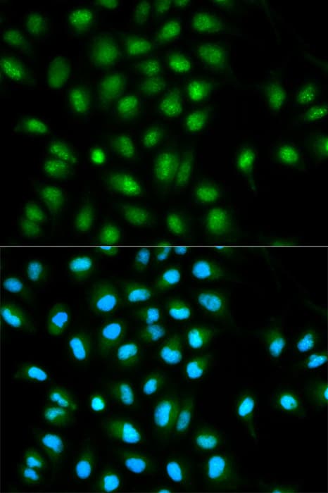 PYCARD / ASC / TMS1 Antibody