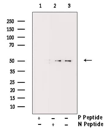 Polyclonal Rabbit anti-Human PDCD4 Antibody (phospho-Ser457, IHC, IF, WB)